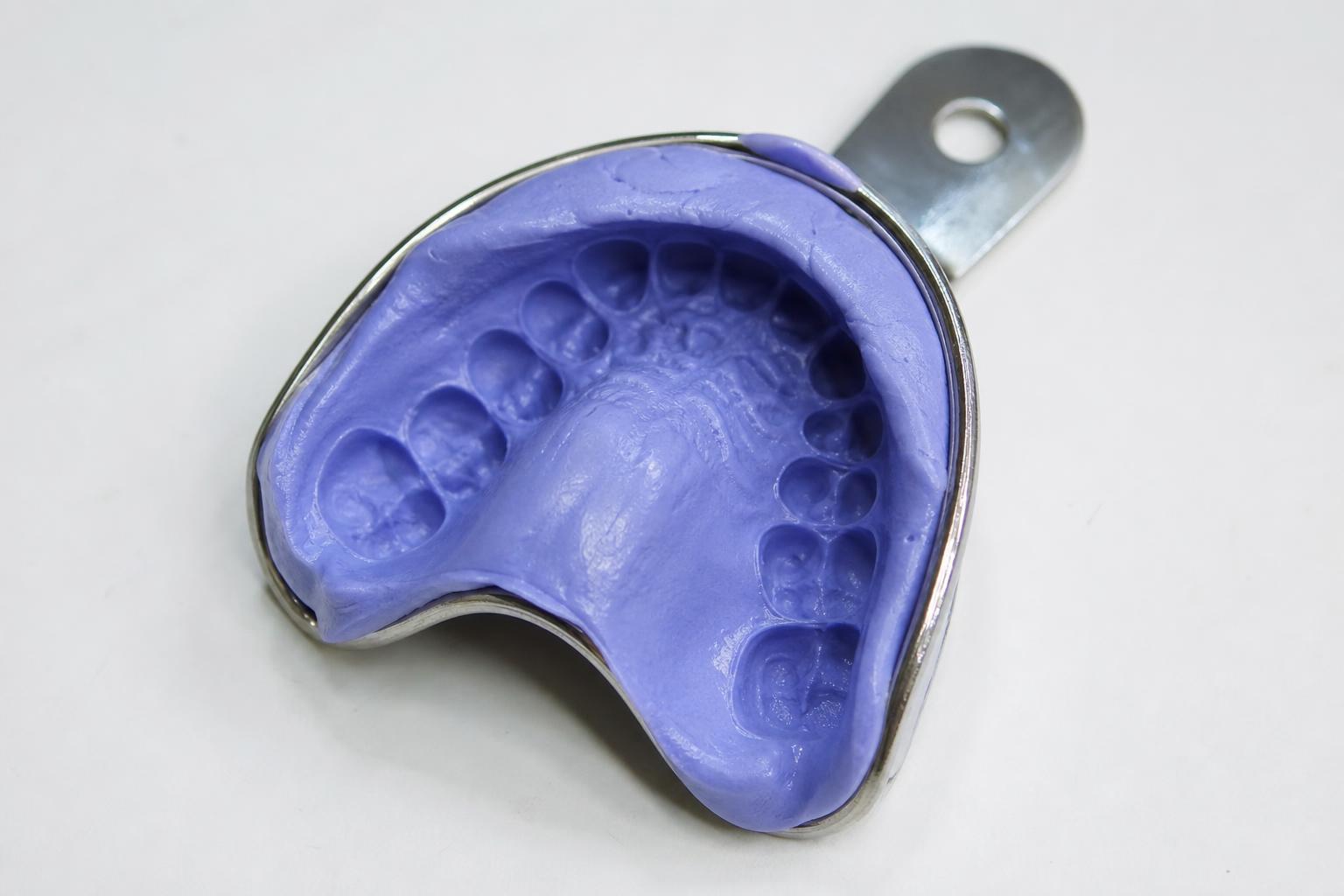 Can Dental Impressions Pull Crowns Out?