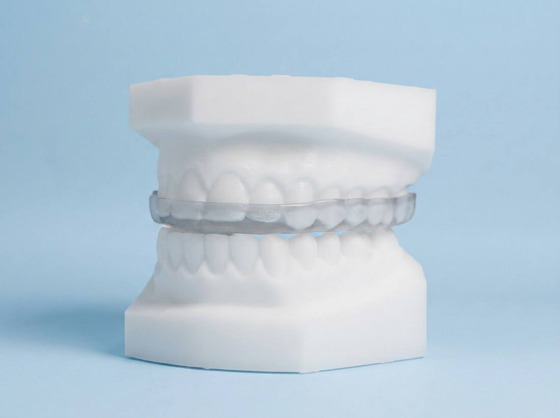 Bite Splints